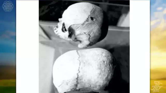 Amazing Elongated Skull Discoveries That Still Baffle Historians