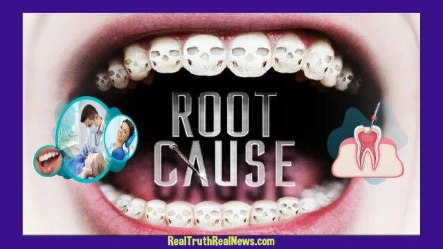 Documentary:  Root Cause  - Health Issues Caused By Root Canal Procedures Such As Panic Attacks Chronic Fatigue  Insomnia and More