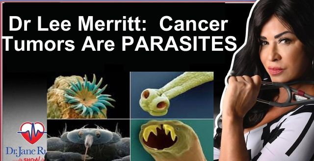 PARASITES:  MEDICAL SYSTEM EXPOSED FOR HIDING REAL CAUSE OF DISEASES