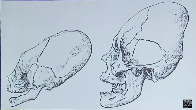 Ancient Elongated Skulls and the Egyptian Akhenaton Connection