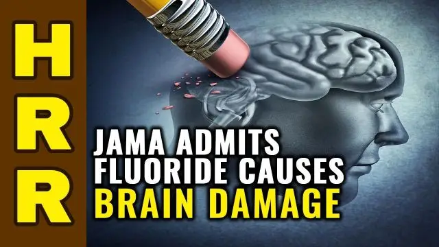 JAMA admits FLUORIDE causes brain damage