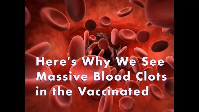 Here's Why We See Massive Blood Clots in The Vaccinated