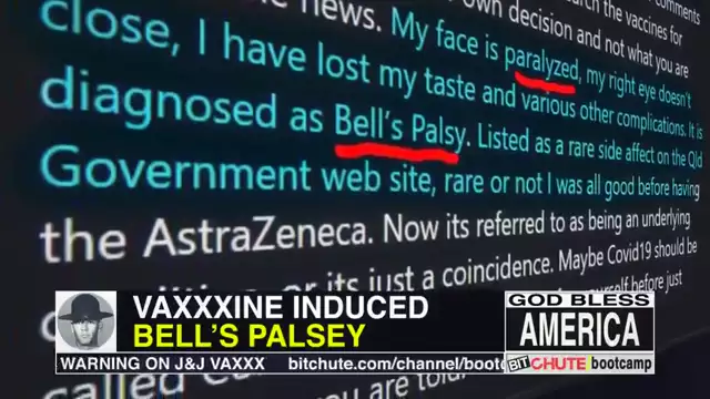 VAXXXINE RUINS MANâ€™S FACE AND LIFE, NOW HIS LOUSY FRIENDS ARE CALLING HIM A CONSPIRACY THEORIST