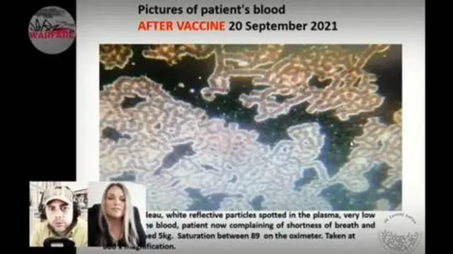 Dr. Botha Finds Foreign Particles, Black Matter and Particles Moving Mechanically in Vaxxed Blood