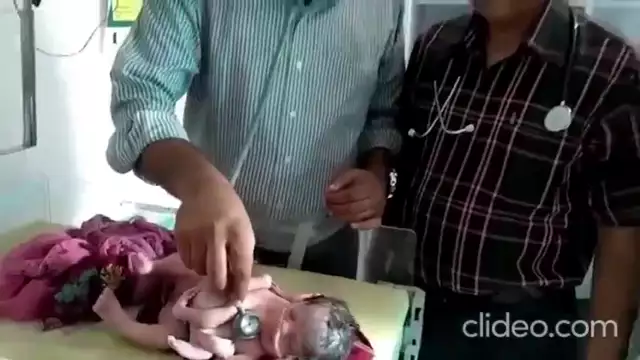 Mutant Vax Babies Being Born After Mothers Receive The Abomination-Jab
