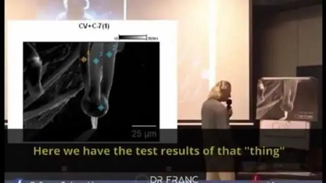 Dr. Franc Zalewski - THE THING! - Another 'LIFE FORM' found in the COVID VAX VIALS (English subs)
