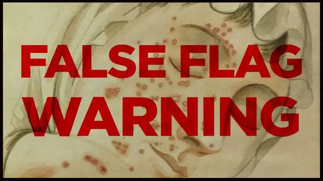 WARNING! TIMELINE SHOWS THREAT OF INCOMING SMALLPOX FALSE FLAG